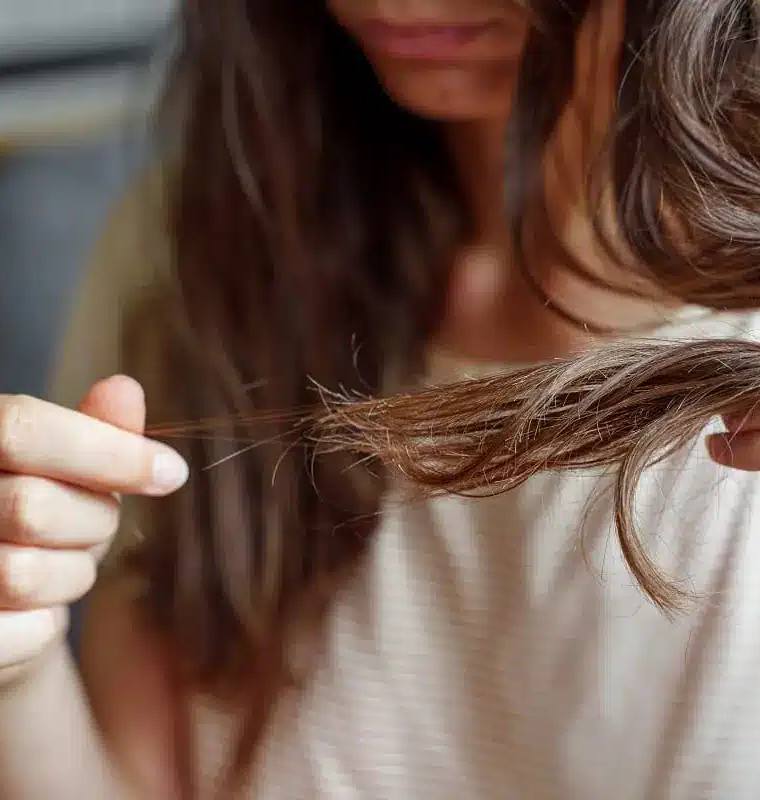 Does Stress Cause Hair Loss? What You Need to Know