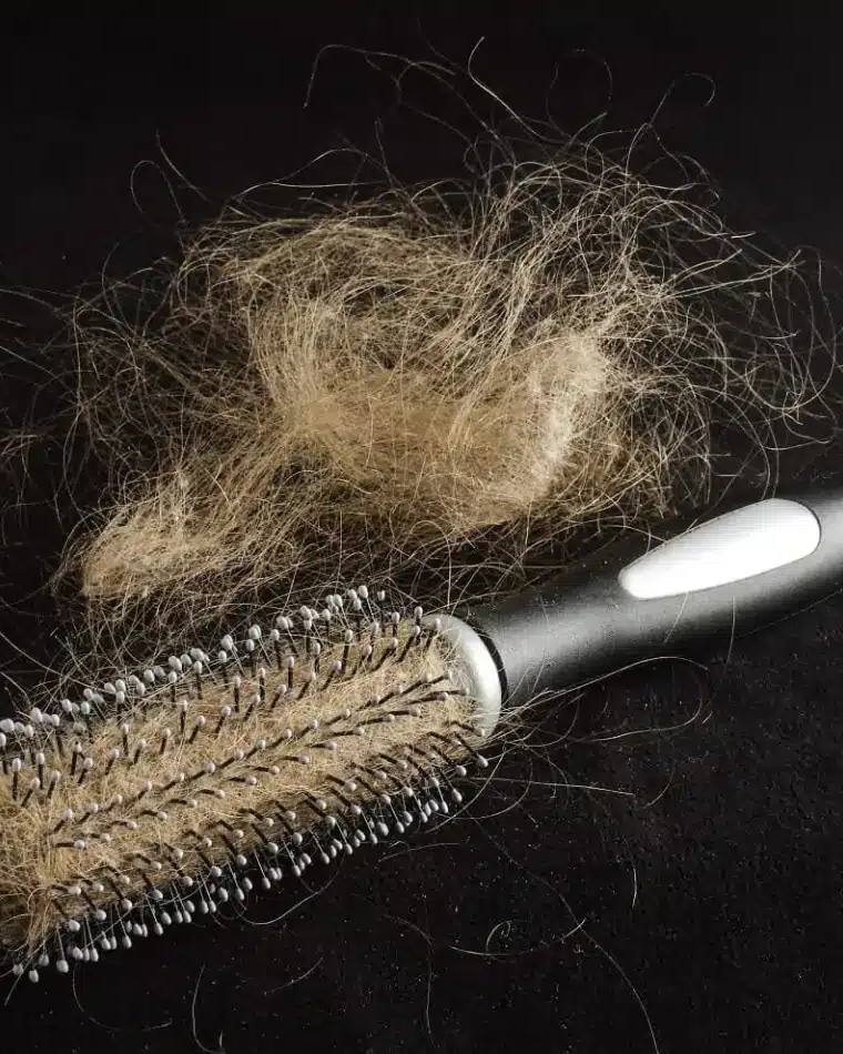 Hair Loss: What to Look for, Why it’s Happening, and What You Can Do