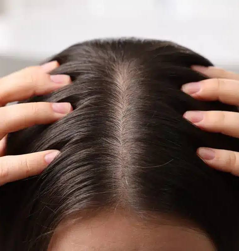 Tips on How to Improve Scalp Health