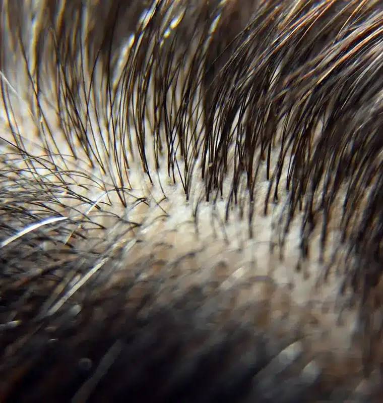 How to Increase Your Hair Density