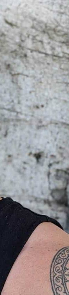 What is scalp micropigmentation
