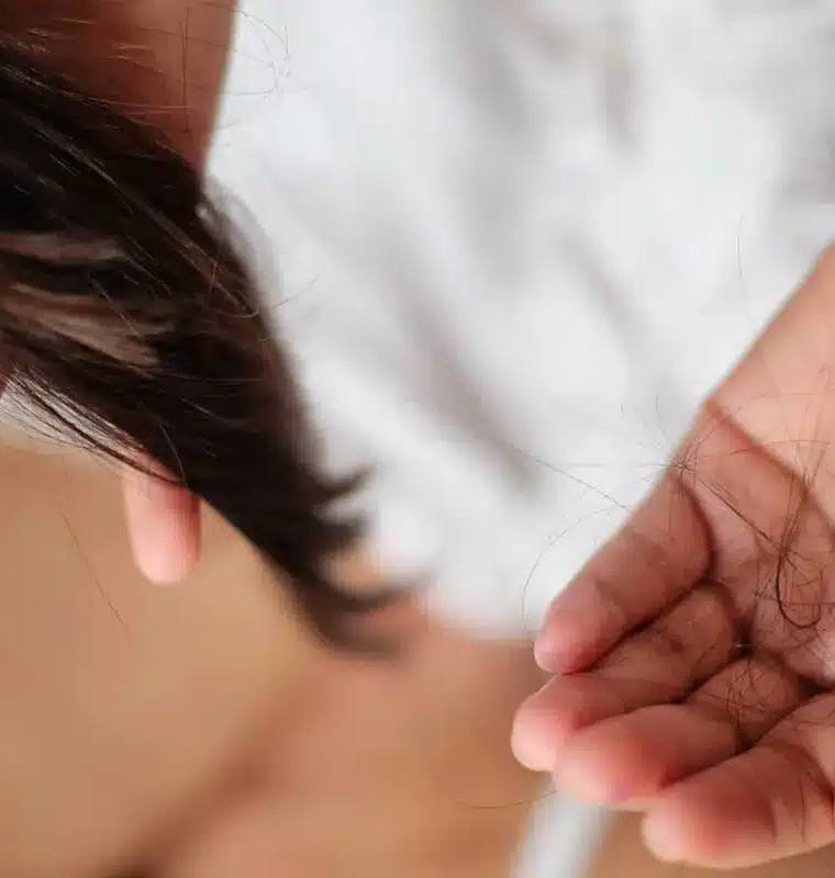 Does Iron Deficiency Cause Hair Loss? Understanding the Connection and Exploring Solutions
